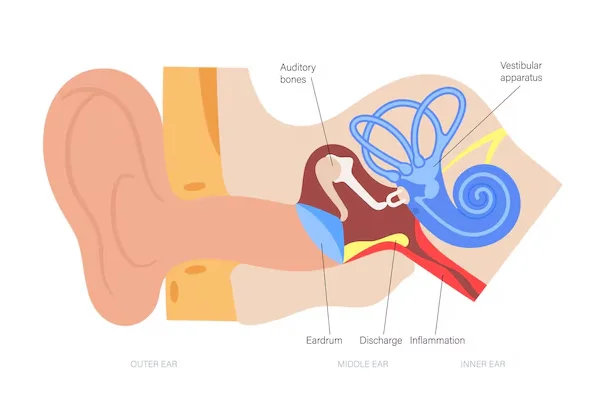 Chronic Otitis Media